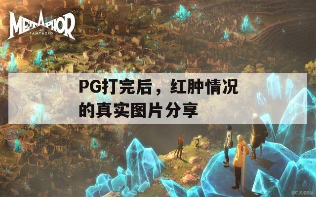 PG打完后，紅腫情況的真實(shí)圖片分享